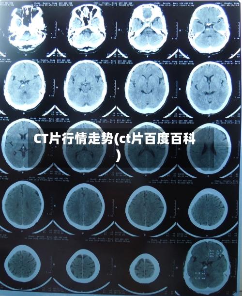 CT片行情走势(ct片百度百科)-第2张图片