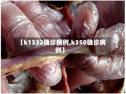 【k1332确诊病例,k350确诊病例】